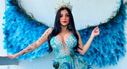 Por esta razón Karely Ruiz pospuso su cirugía estética