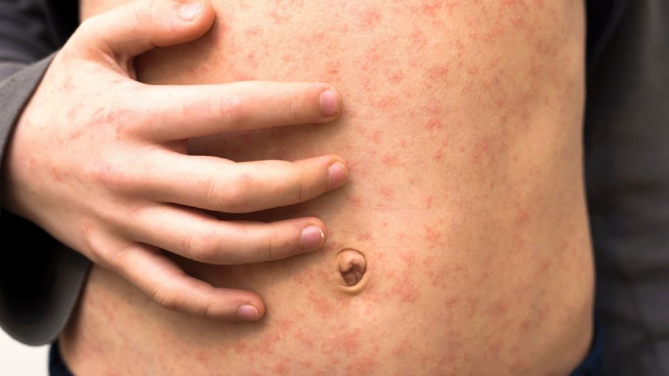 Se ha intensificado la campaña de campo en las alcaldías Álvaro Obregón y Cuajimalpa.