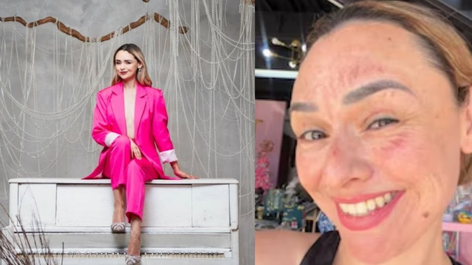 Influencer se quema el rostro en su cumpleaños por hacer trend viral