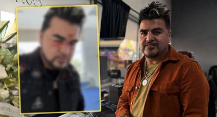 ‘El Mimoso’ desata misterio tras mostrar foto con aparentes golpes