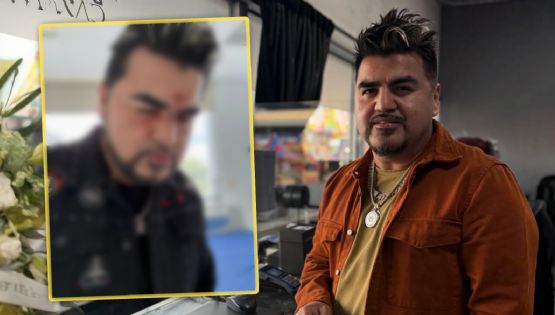 ‘El Mimoso’ desata misterio tras mostrar foto con aparentes golpes