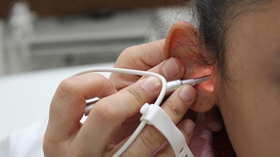 Se realizó la primera jornada quirúrgica institucional de implante cocleares.