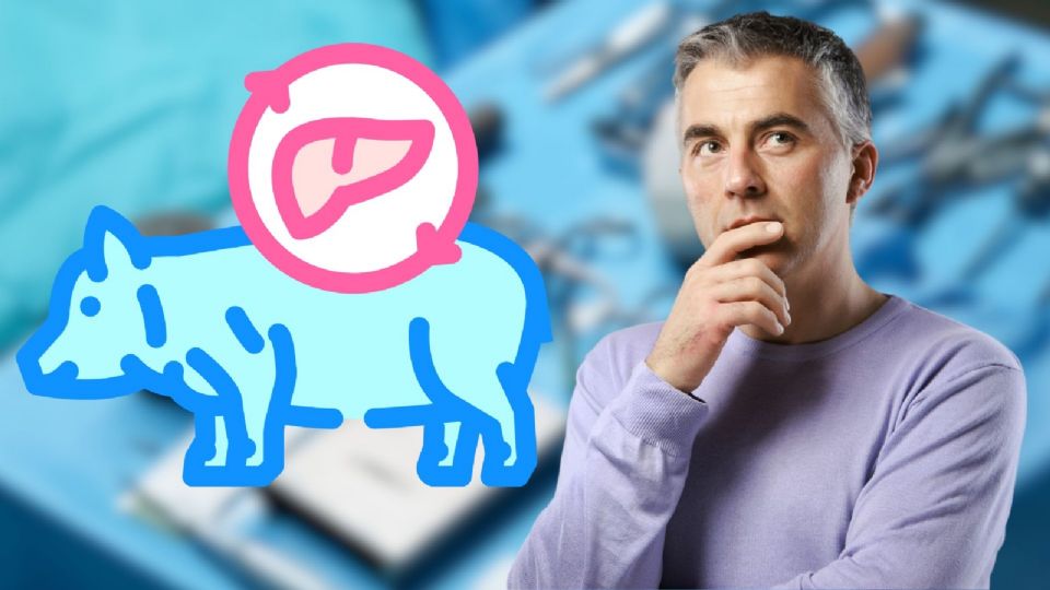 El trasplante de hígado es el tercer tipo de trasplante de órganos más común a nivel global.