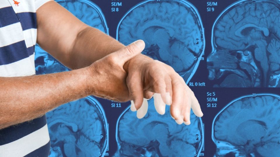 El tratamiento actual se basa en suplementar la dopamina de forma externa para aliviar los síntomas.