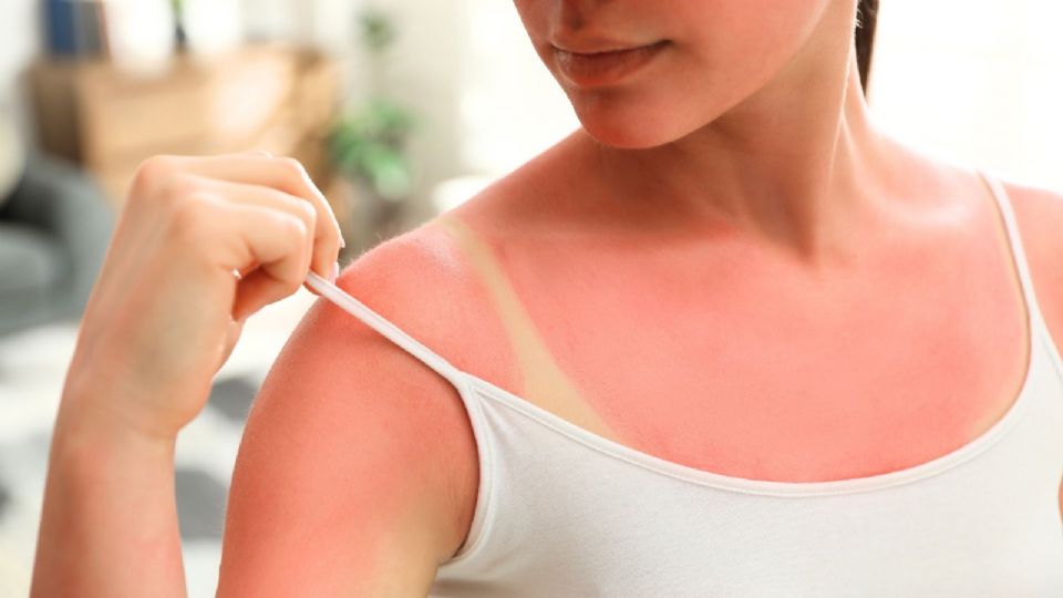 No dejes pasar ninguna recomendación.