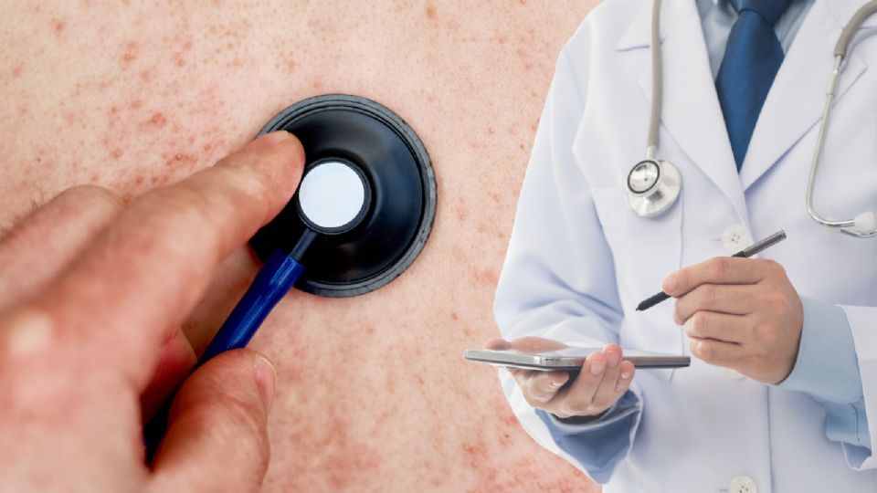 El llamado a la población es claro: completar esquemas de vacunación.