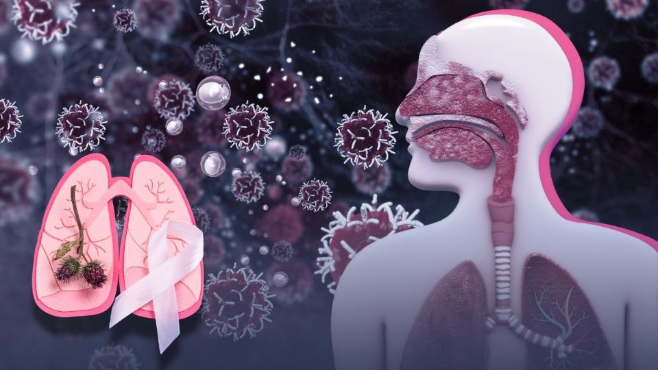 Día Nacional del Cáncer de Pulmón: ¿por qué se conmemora hoy 5 de abril?