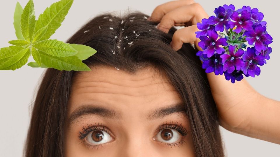 La jabonera y la verbena, plantas tradicionales mexicanas, son aliadas contra la caspa.