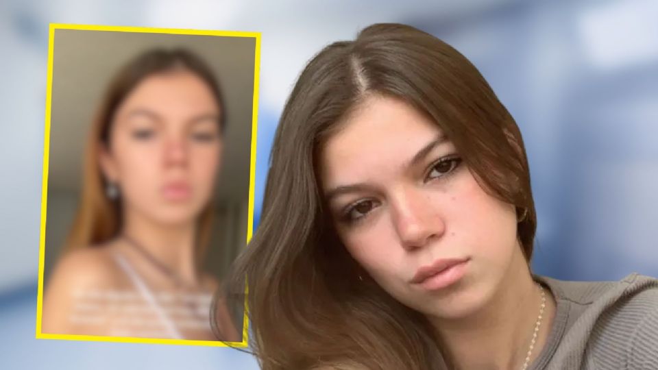 Del coma a la resiliencia: Valentina Gilabert vuelve a la 'normalidad' tras ataque.