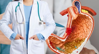 Lo que debes saber sobre la enfermedad inflamatoria intestinal, según una gastroenteróloga