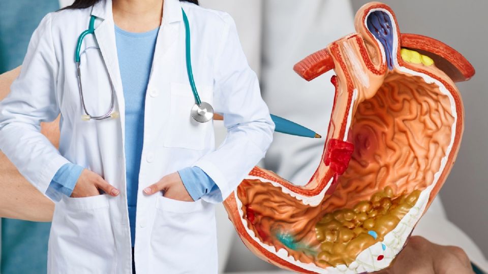 Todo sobre la enfermedad inflamatoria intestinal: diagnóstico, síntomas y mitos comunes.