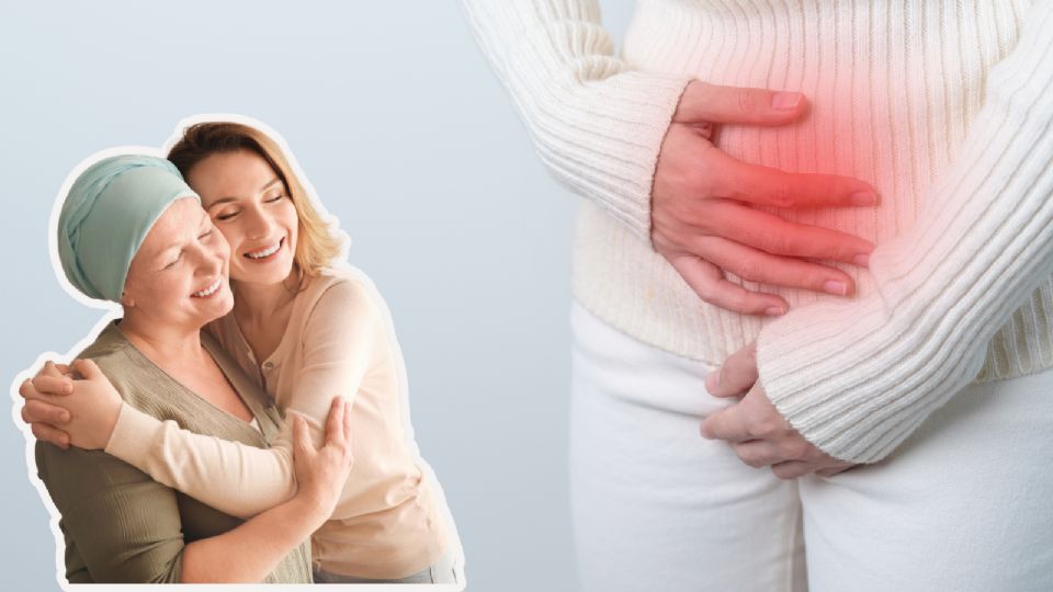 El cáncer de ovario es curable en el 90 por ciento de los casos, siempre y cuando se detecte a tiempo.