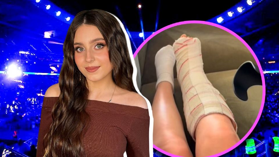 Roro Bueno sufre fractura en su pie.