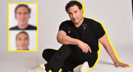 Eduardo Yáñez sorprende con nuevo look: así luce tras someterse a un rejuvenecimiento facial
