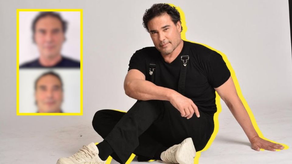 VIDEO | Así luce Eduardo Yañez tras su rejuvenecimiento facial