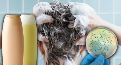 Profeco alerta por marca de shampoo contaminado con bacteria que puede provocar infecciones