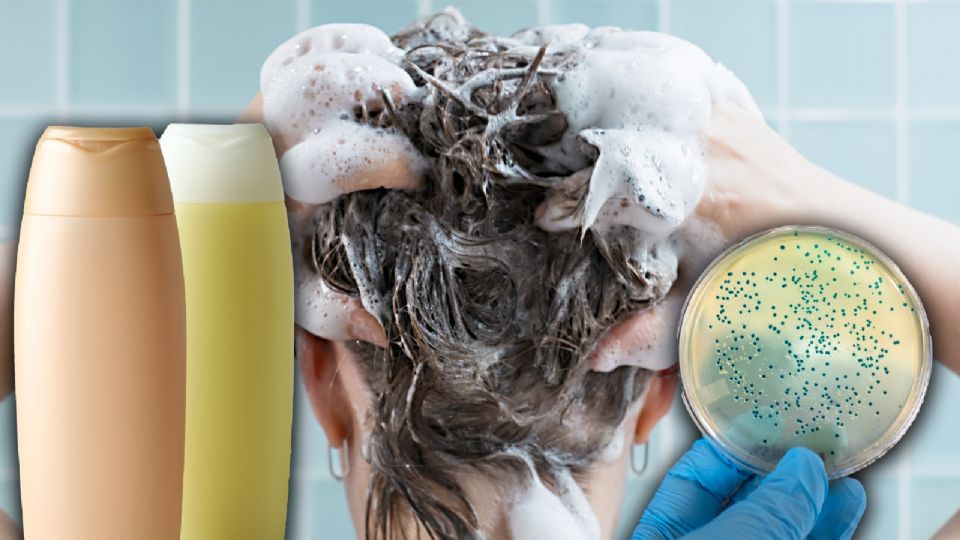 Profeco alerta por shampoo contaminado con bacteria.