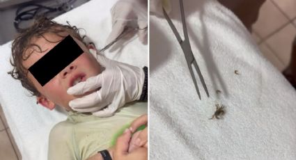 VIDEO | Cangrejo se mete a oreja de niño y su reacción se hizo viral