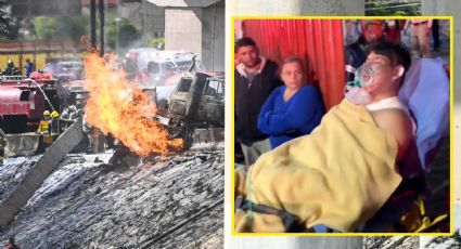 ‘Nada volverá a ser igual’: Madre de joven herido tras explosión de pipa en Iztapalapa pide justicia