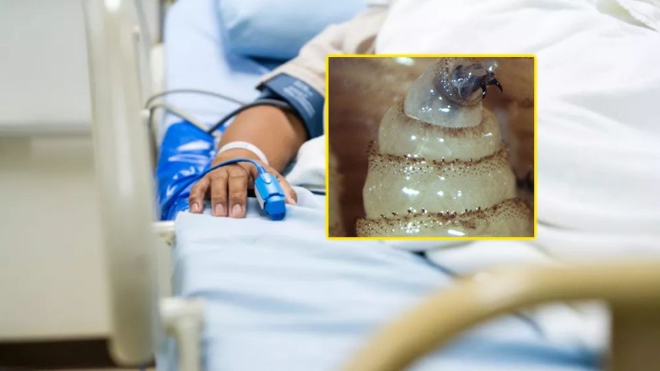 Dos personas fallecen por miasis de gusano barrenador en México