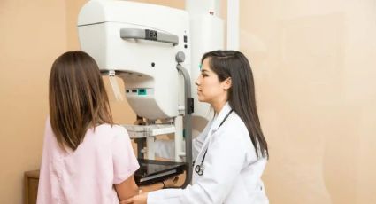 Mito desmentido: las mastografías no provocan cáncer