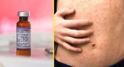 CDMX refuerza vacunación y protocolos ante casos de sarampión