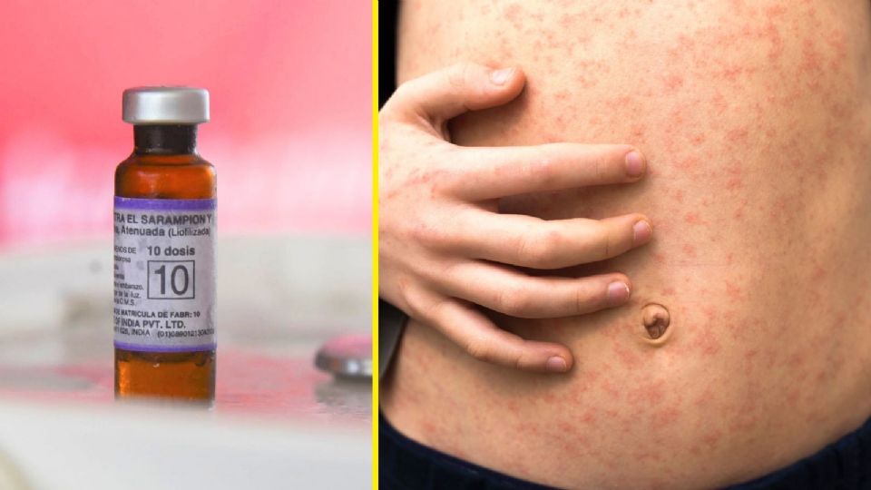 CDMX intensifica la vacunación para frenar contagios de sarampión.