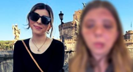 VIDEO | Joven universitaria acusa a su expareja de agresión violenta en la Ciudad de México