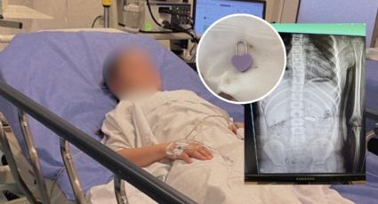 Este es el estado de salud de la niña que ingirió un candado en Montemorelos