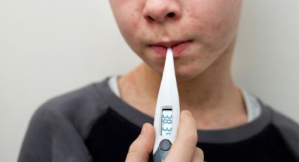 Confirman primer caso de sarampión en Nuevo León; es un niño de 11 años