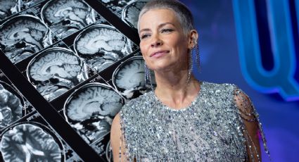 Evangeline Lilly: ¿Por qué la protagonista de Ant-Man de Marvel tiene daño cerebral?