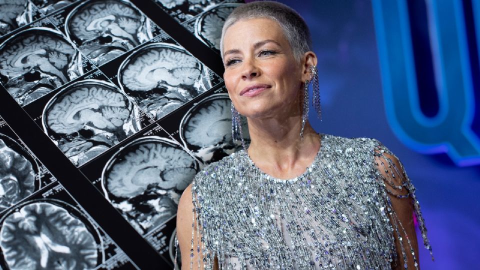 Evangeline Lilly compartió los resultados de sus escaneos cerebrales con sus seguidores en Instagram.