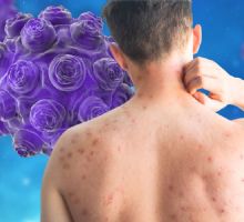 Campaña de vacunación contra el sarampión en CDMX: ¿Dónde y quiénes deben vacunarse?