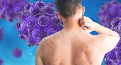 Campaña de vacunación contra el sarampión en CDMX: ¿Dónde y quiénes deben vacunarse?