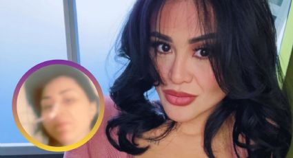 Gomita revela que estuvo 'al borde de la muerte': ¿Cuál es el estado de salud de Araceli Ordaz?