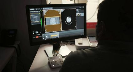 ISSSTE reactiva tomógrafo en hospital de Tultitlán; supera los 280 estudios tras mantenimiento