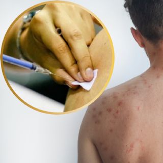 Será en noviembre cuando México comparezca ante la OMS por sarampión