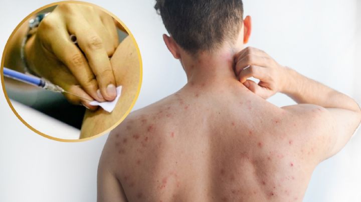 Será en noviembre cuando México comparezca ante la OMS por sarampión