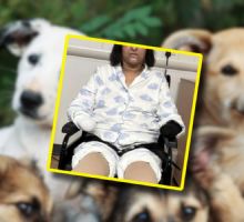 Mujer pierde manos y piernas tras ser lamida por su perro