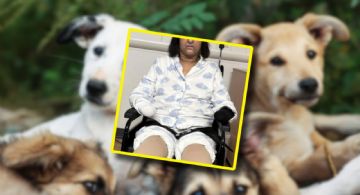 Mujer pierde manos y piernas tras ser lamida por su perro