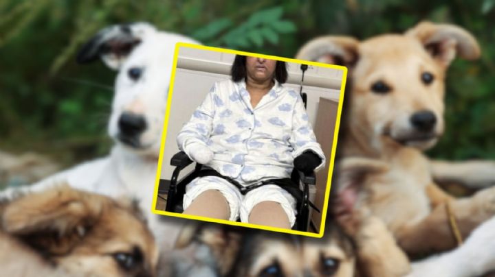 Mujer pierde manos y piernas tras ser lamida por su perro