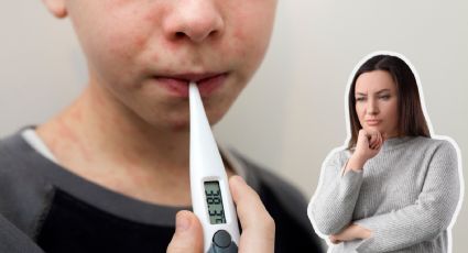 Sarampión en Nuevo León: confirman ocho casos en 2026 y sube la tasa de contagio