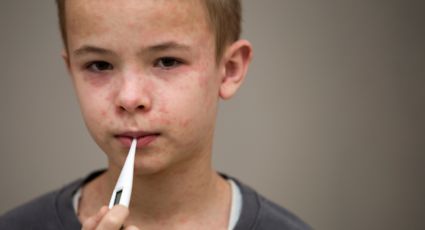 Confirma nuevo caso de sarampión en Nuevo León; ya suma 51 contagios en 2026