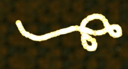 Ébola en Italia: Activan protocolo por posible contagio en hospital
