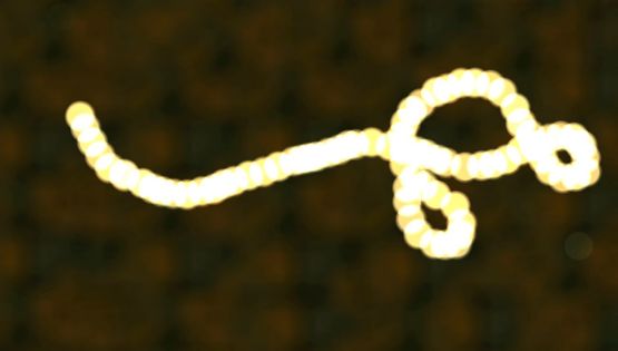 Ébola en Italia: Activan protocolo por posible contagio en hospital