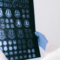 ¿Como IA? Tu cerebro predice palabras estando inconsciente