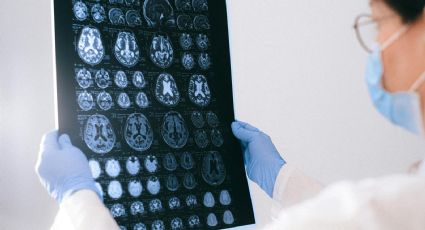 ¿Como IA? Tu cerebro predice palabras estando inconsciente