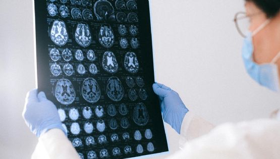 ¿Como IA? Tu cerebro predice palabras estando inconsciente