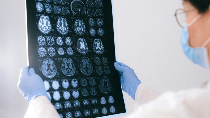 ¿Como IA? Tu cerebro predice palabras estando inconsciente
