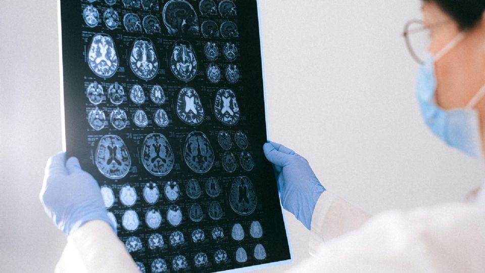 La actividad neuronal durante la anestesia revela procesos cognitivos ocultos en el cerebro en estado de inconsciencia.
